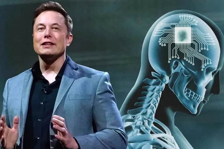 Le premier patient de Neuralink capable de contrôler une souris par la pensée