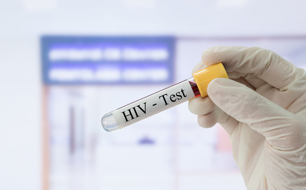 Démarrage de la campagne nationale de dépistage du VIH