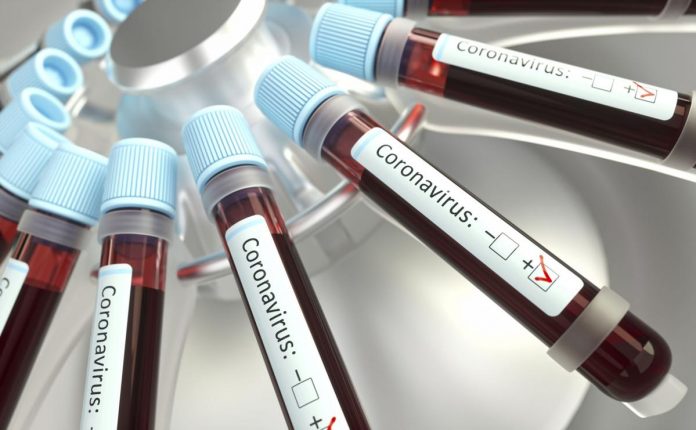 Coronavirus : 22 nouveaux cas au Maroc et une guérison de plus