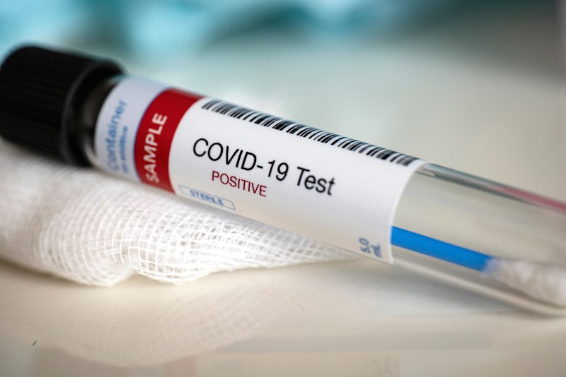 Coronavirus Maroc : 227 cas de plus et 18 nouvelles guérisons