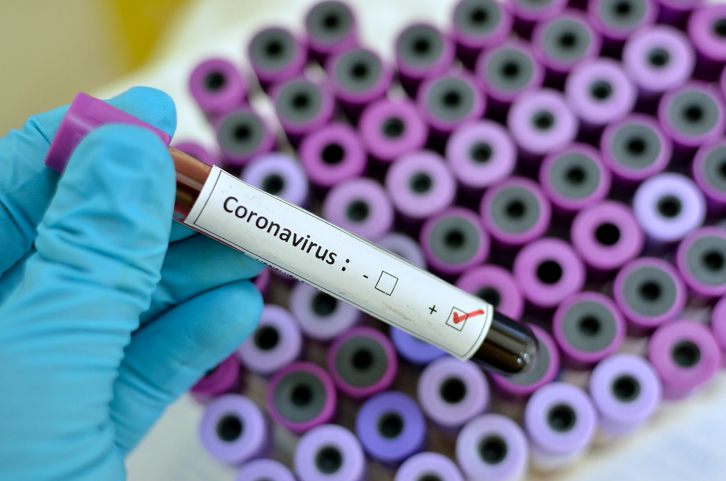 Coronavirus :  106 nouveaux cas au Maroc, 17 guérisons de plus