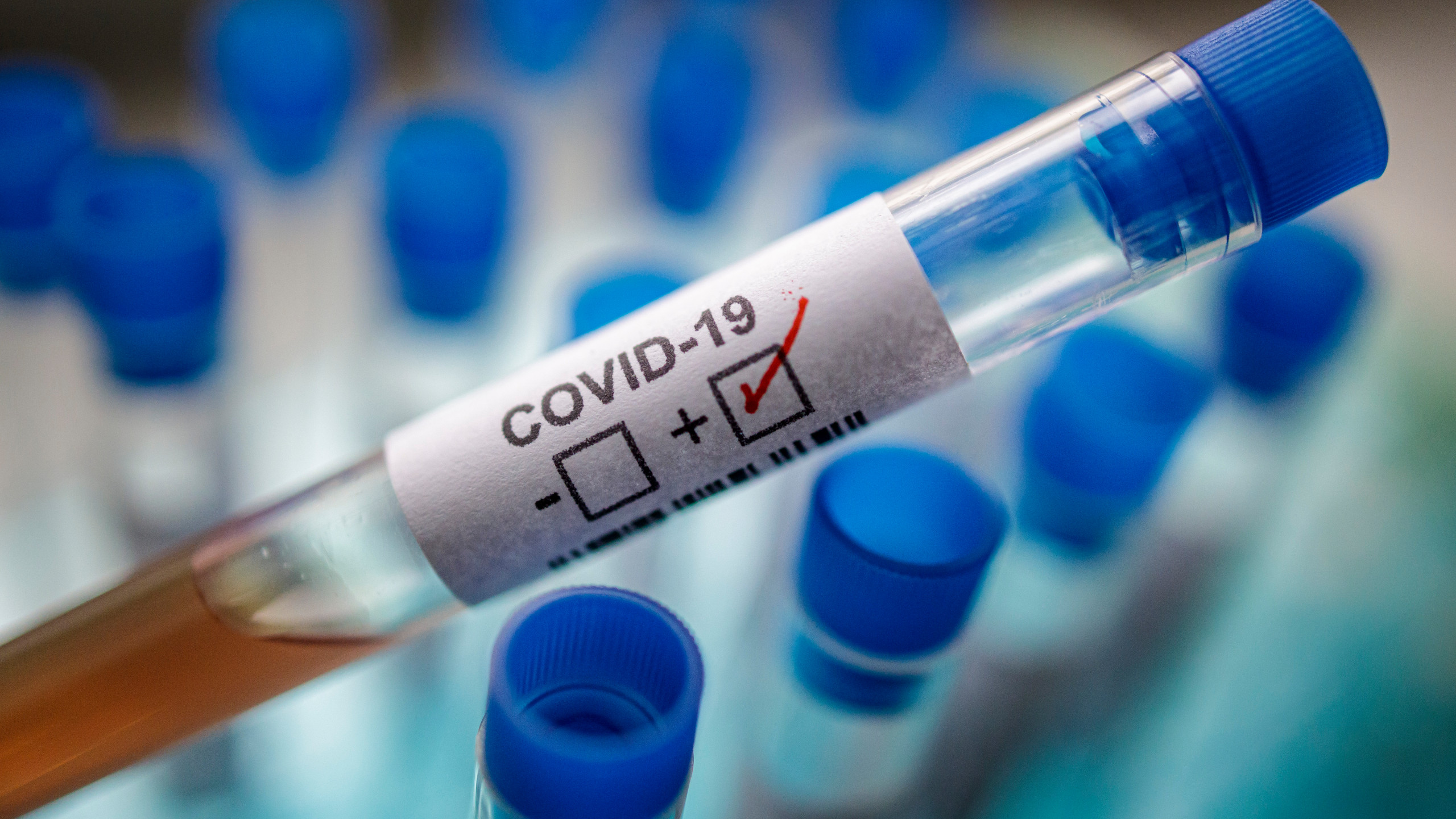 Coronavirus Maroc : Les décès en baisse