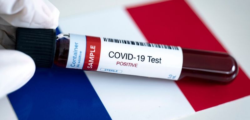 Covid-19:  349 nouveaux cas de contamination, le mercredi 24 juin à 10H