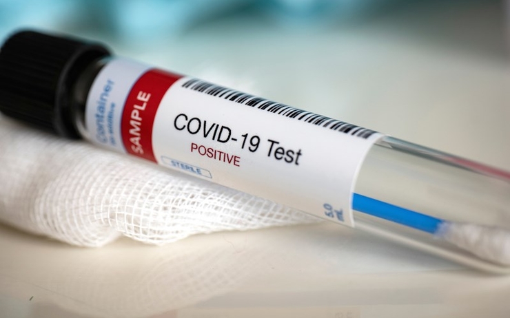 Covid-19: 63 contaminations et 58 guérisons, la matinée du 1er juillet à 10H