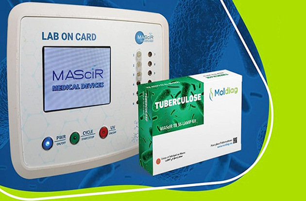 MAScIR lance le premier test de diagnostic de la tuberculose 100% marocain